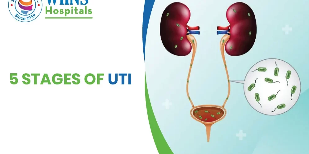 5 Stages of UTI