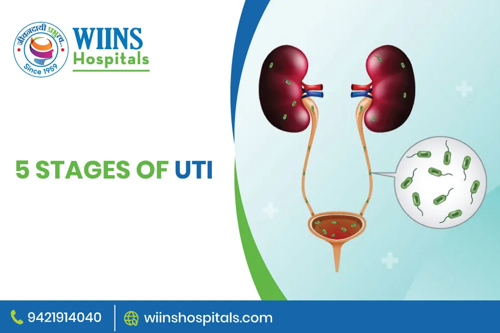 5 Stages of UTI