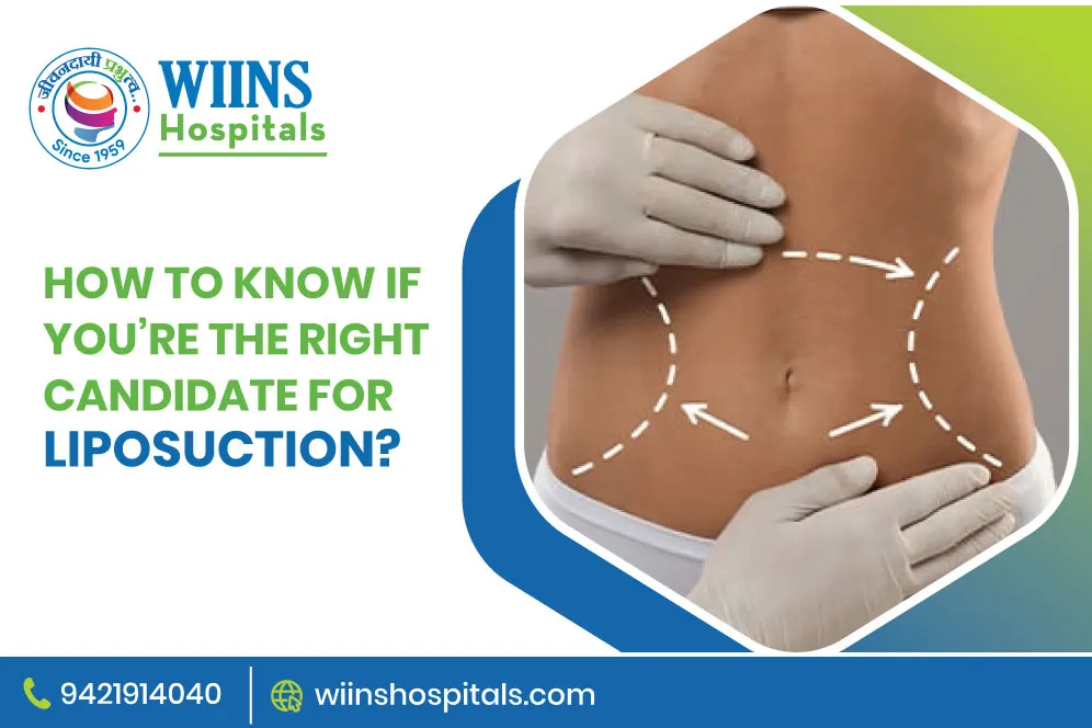 How to Know If You’re the Right Candidate for Liposuction?
