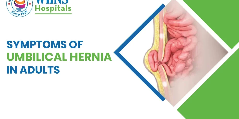 Symptoms of Umbilical Hernia in Adults