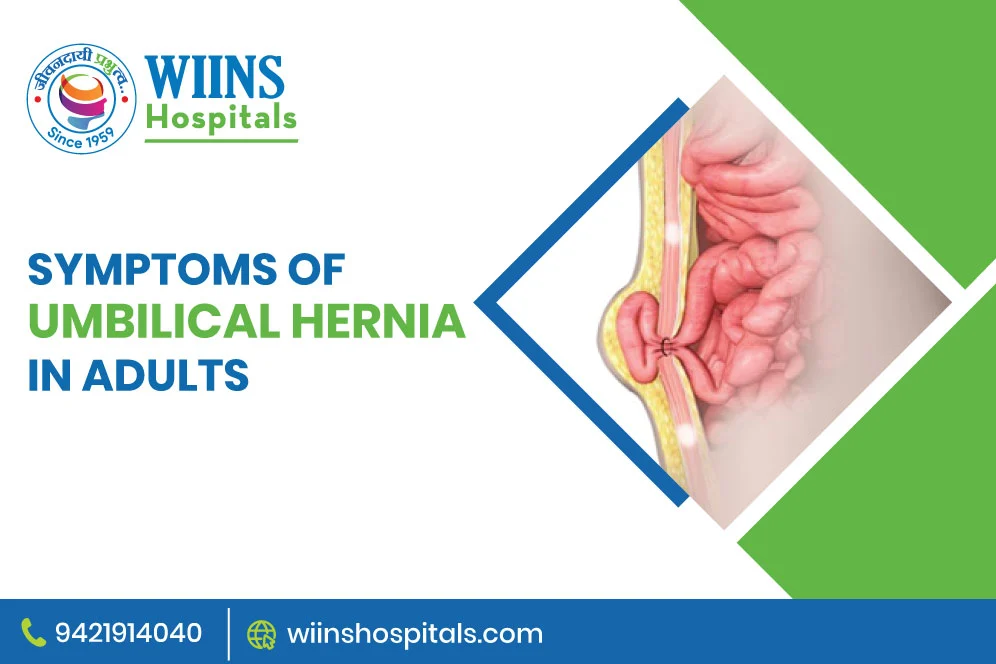 Symptoms of Umbilical Hernia in Adults
