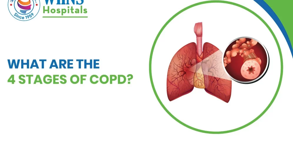 What Are the 4 Stages of COPD?