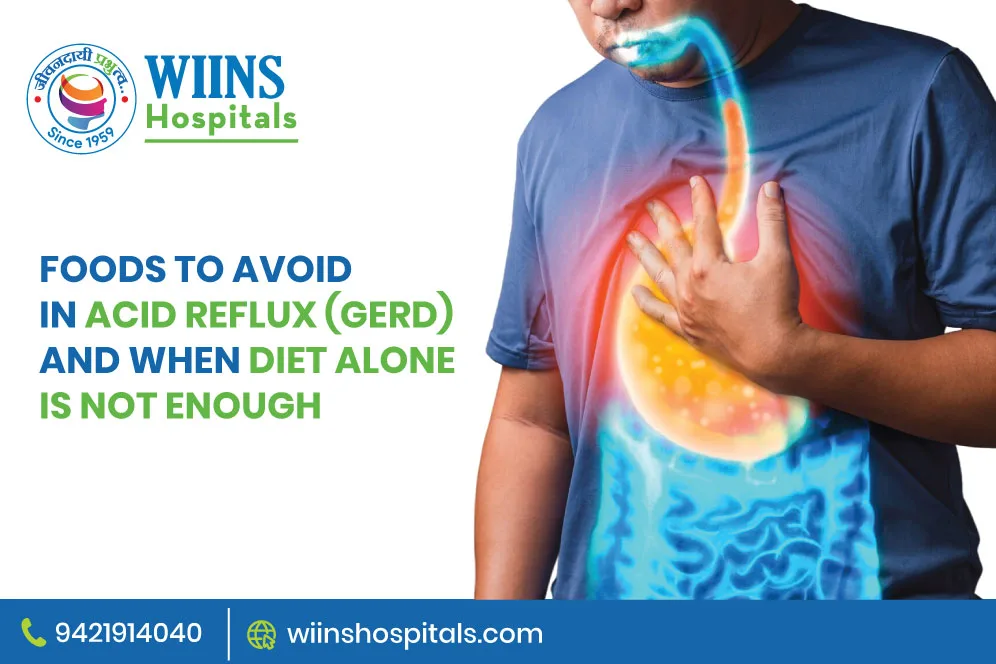 Foods to Avoid in Acid Reflux (GERD) And When Diet Alone Is Not Enough