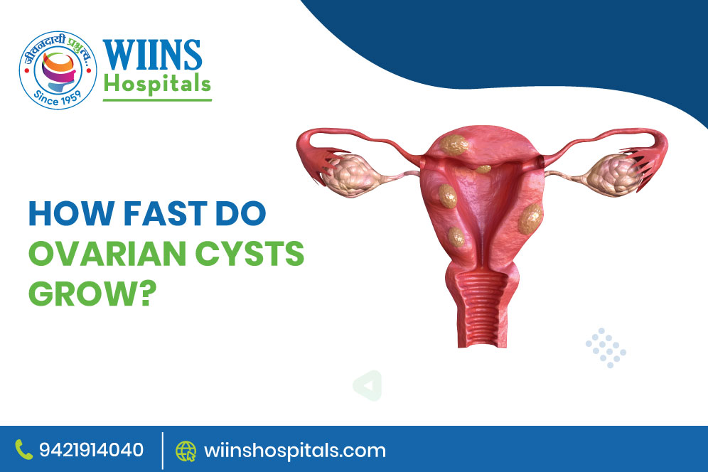 How fast do ovarian cysts grow