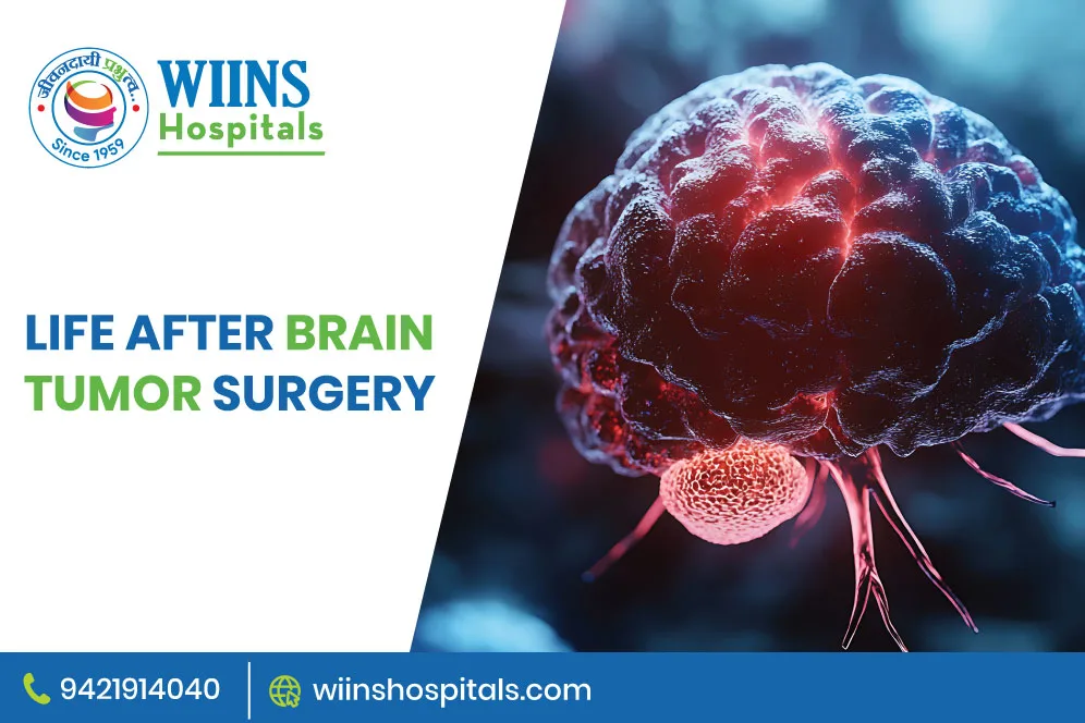 Life After Brain Tumor Surgery