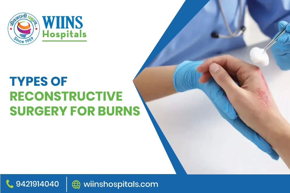 Types of Reconstructive Surgery for Burns