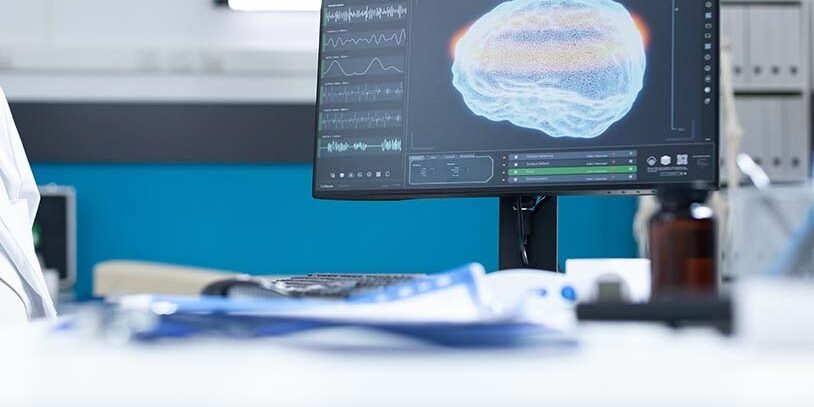 Understanding Intraoperative Nerve Monitoring For Brain Tumor Surgery