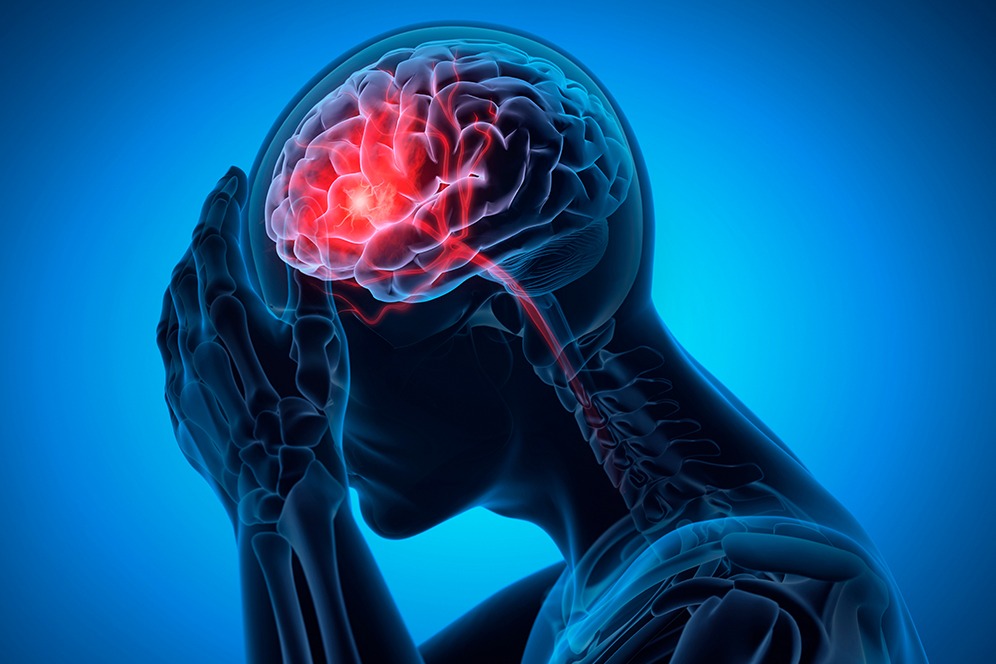 Understanding The Connection Between Hypertension And Brain Stroke