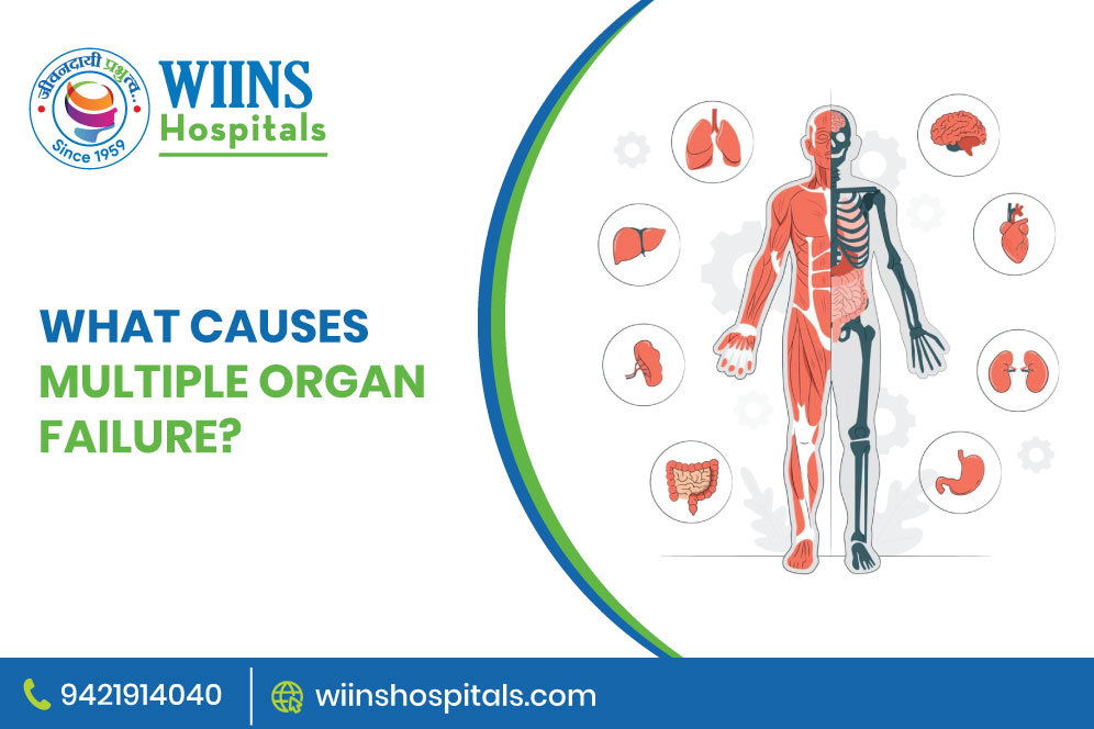 What Causes Multiple Organ Failure