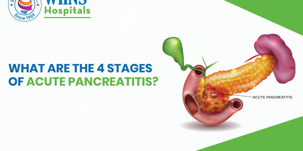 What are the 4 stages of acute pancreatitis