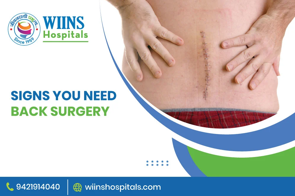 Signs You Need Back Surgery