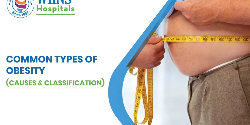 Common Types of Obesity