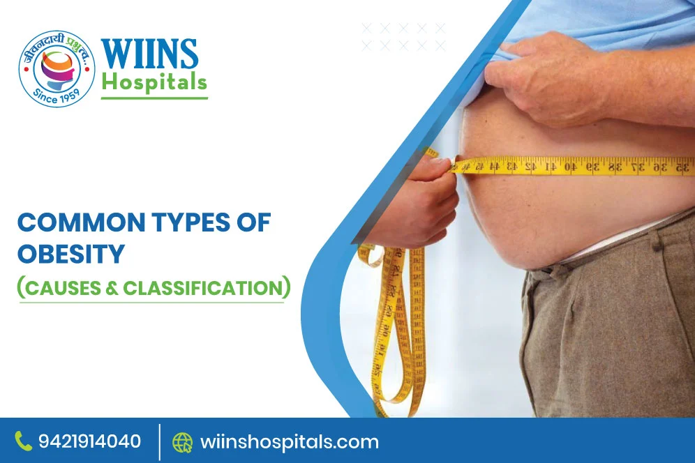 Common Types of Obesity