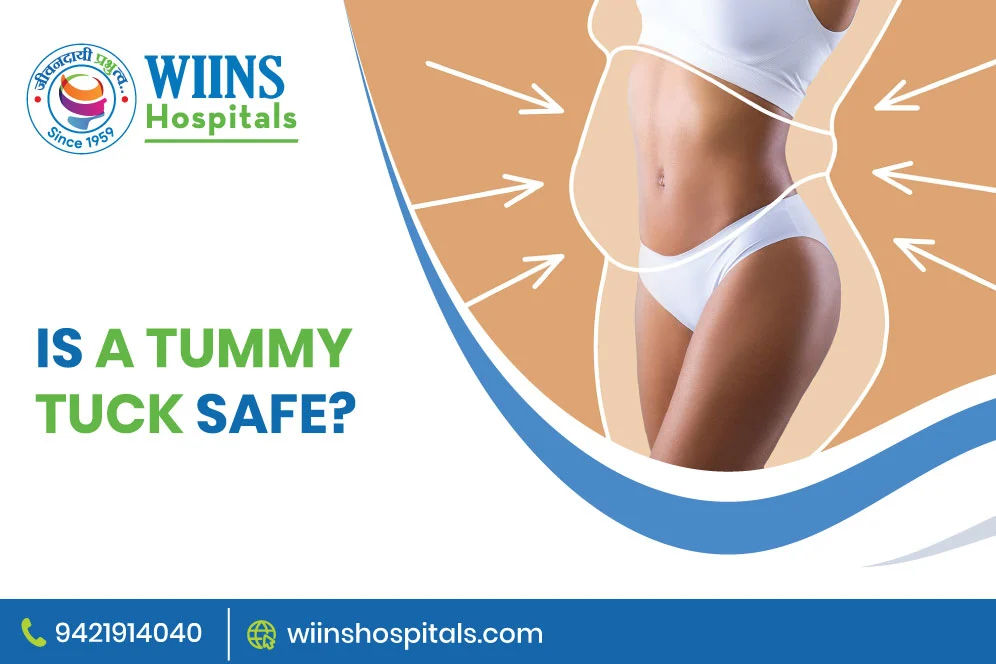 Is a Tummy Tuck Safe?