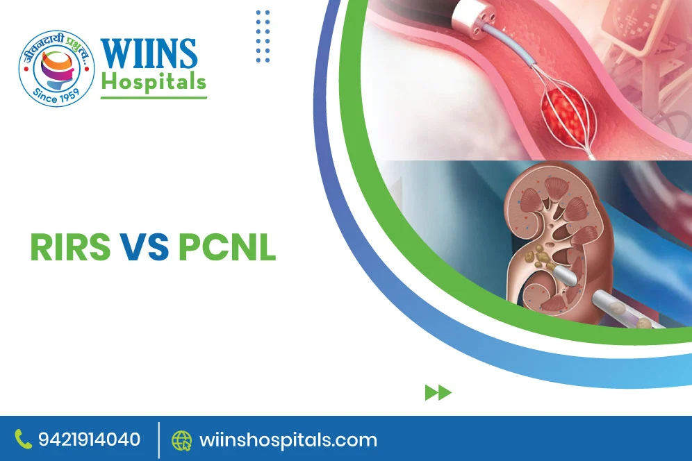 RIRS vs PCNL: Which Treatment Option is Better for Kidney Stones?
