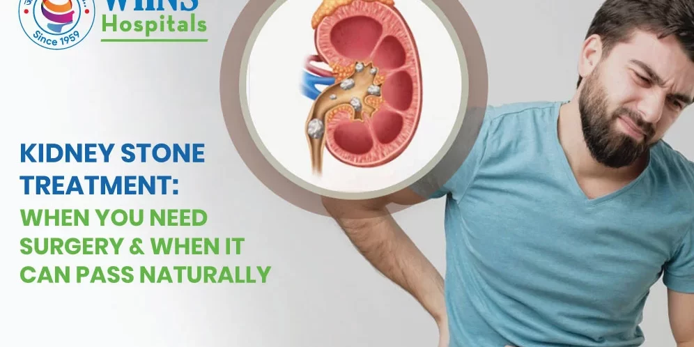 Kidney Stone Treatment: When You Need Surgery & When It Can Pass Naturally