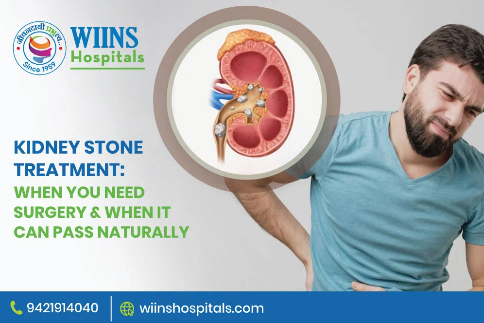 Kidney Stone Treatment: When You Need Surgery & When It Can Pass Naturally