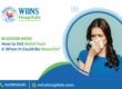 Blocked Nose: How to Get Relief Fast & When It Could Be Sinusitis