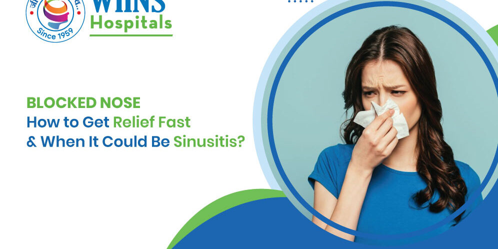 Blocked-Nose Blocked Nose: How to Get Relief Fast & When It Could Be Sinusitis