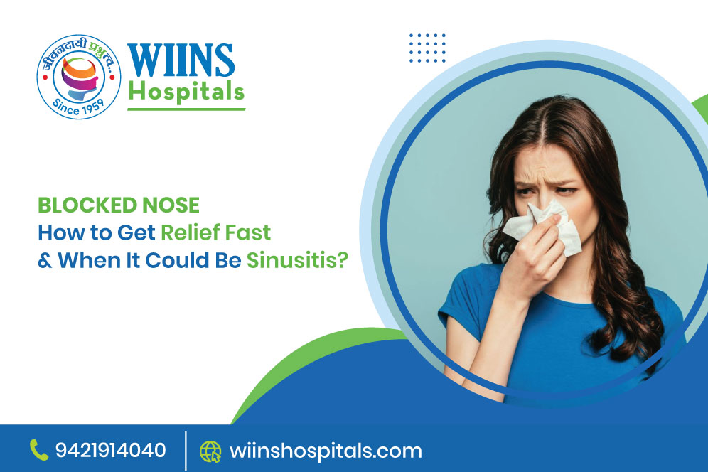 Blocked Nose: How to Get Relief Fast & When It Could Be Sinusitis