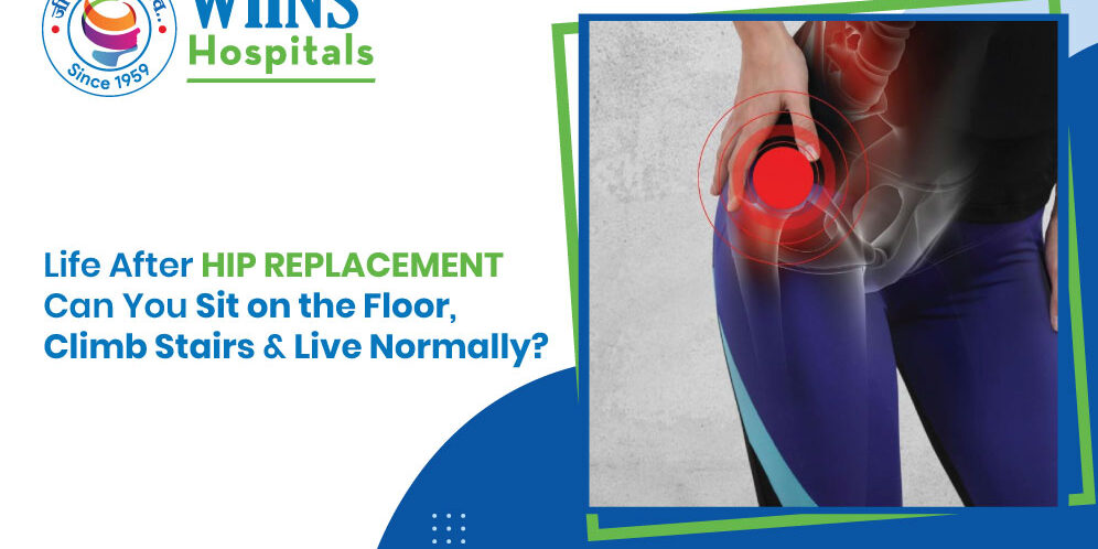 Hip-Replacement Life After Hip Replacement: Can You Sit on the Floor, Climb Stairs & Live Normally?