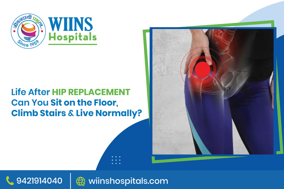 Life After Hip Replacement: Can You Sit on the Floor, Climb Stairs & Live Normally?