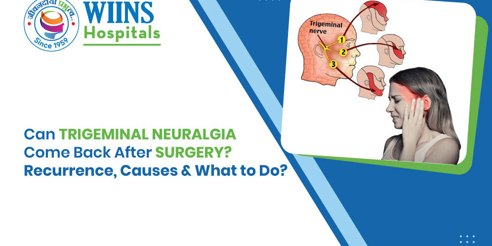 Trigeminal-Neuralgia Can Trigeminal Neuralgia Come Back After Surgery? Recurrence, Causes & What to Do
