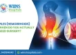Piles (Hemorrhoids): When Do You Actually Need Surgery?