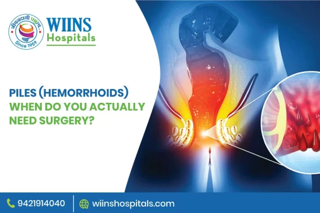 Piles (Hemorrhoids): When Do You Actually Need Surgery?