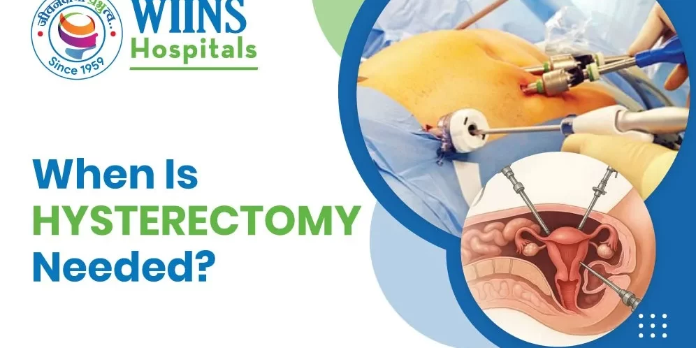 When Is a Hysterectomy Needed When Is a Hysterectomy Needed