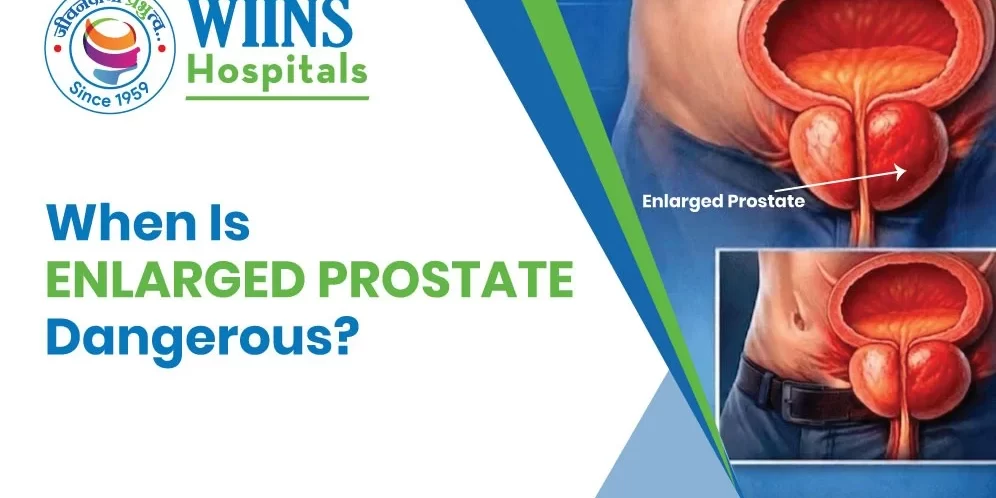 When Is Enlarged Prostate Dangerous?
