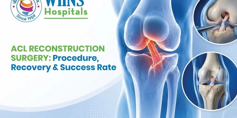 ACL Reconstruction Surgery: Procedure, Recovery & Success Rate ACL Reconstruction Surgery: Procedure, Recovery & Success Rate