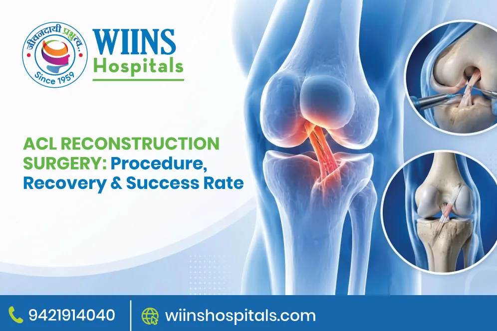 ACL Reconstruction Surgery: Procedure, Recovery & Success Rate