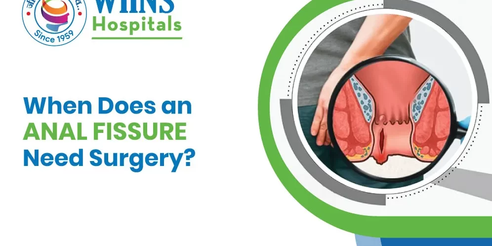 When Does an Anal Fissure Need Surgery? When Does an Anal Fissure Need Surgery?