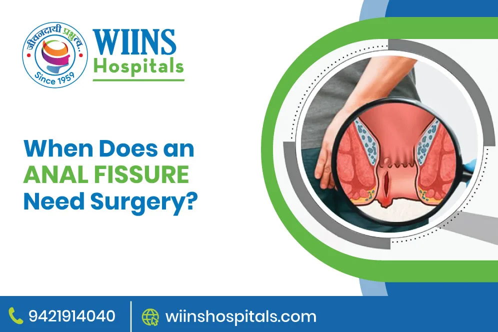 When Does an Anal Fissure Need Surgery?