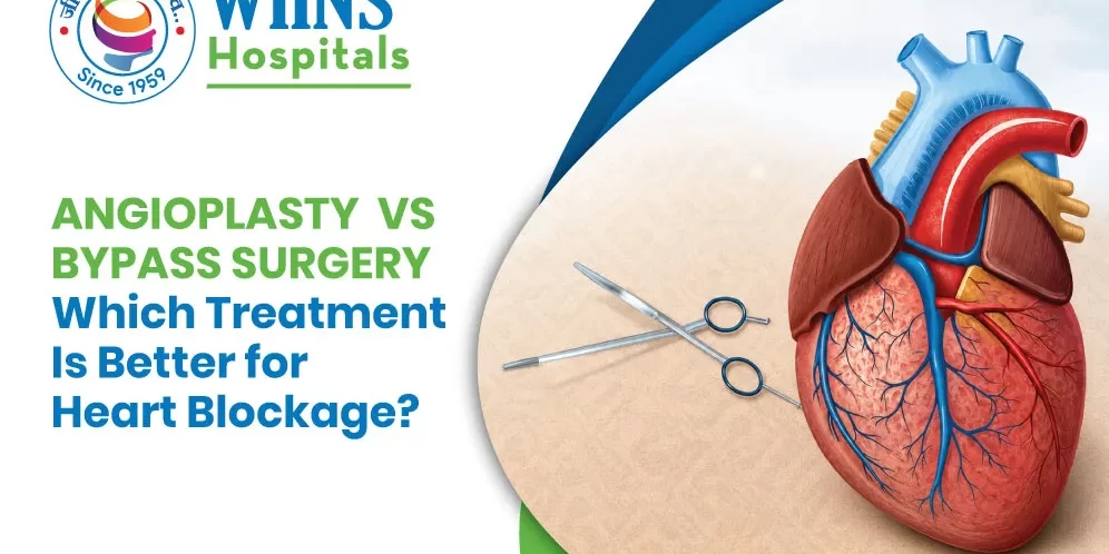 Angioplasty vs Bypass Surgery: Which Treatment Is Better for Heart Blockage? Angioplasty vs Bypass Surgery: Which Treatment Is Better for Heart Blockage?