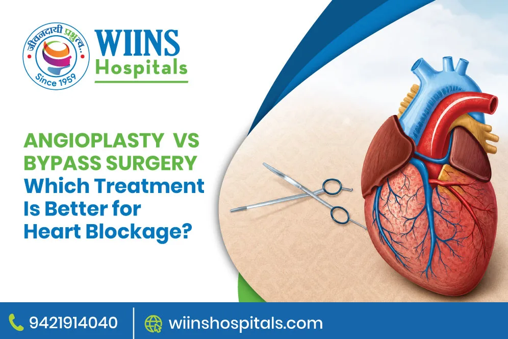 Angioplasty vs Bypass Surgery: Which Treatment Is Better for Heart Blockage?