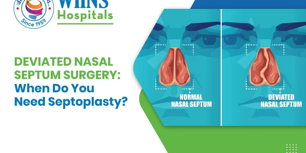 Image Alt Text – Deviated Nasal Septum Surgery: When Do You Need Septoplasty? Image Alt Text - Deviated Nasal Septum Surgery: When Do You Need Septoplasty?