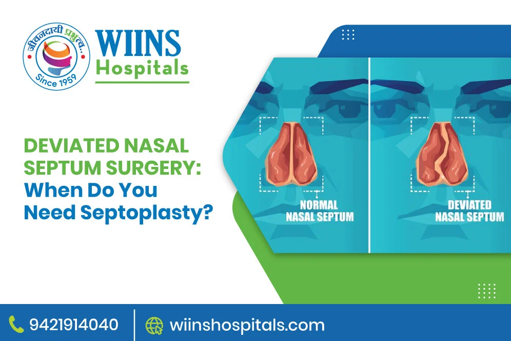Image Alt Text - Deviated Nasal Septum Surgery: When Do You Need Septoplasty?