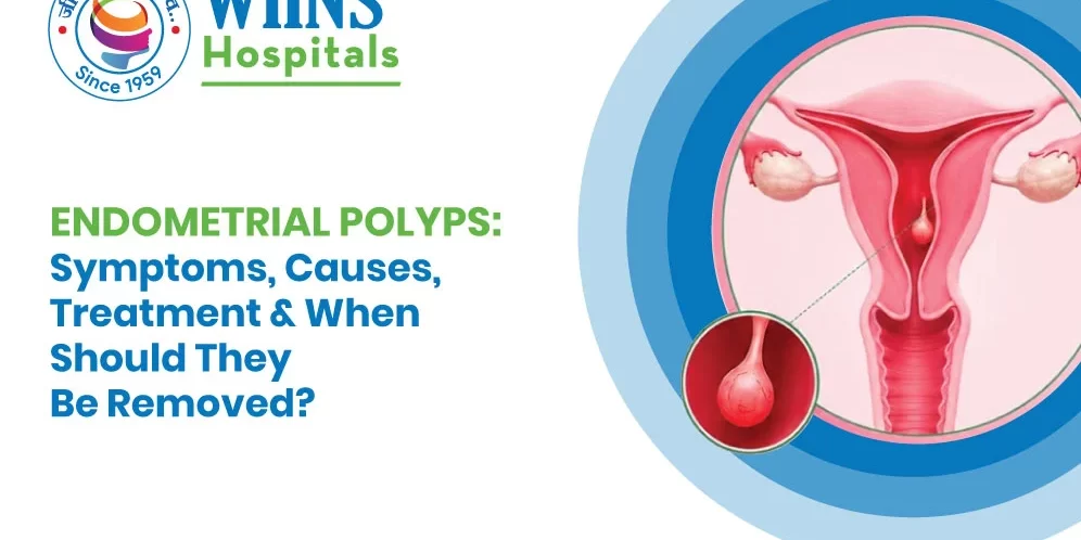 Endometrial Polyps: Symptoms, Causes, Treatment & When Should They Be Removed? Endometrial Polyps: Symptoms, Causes, Treatment & When Should They Be Removed?
