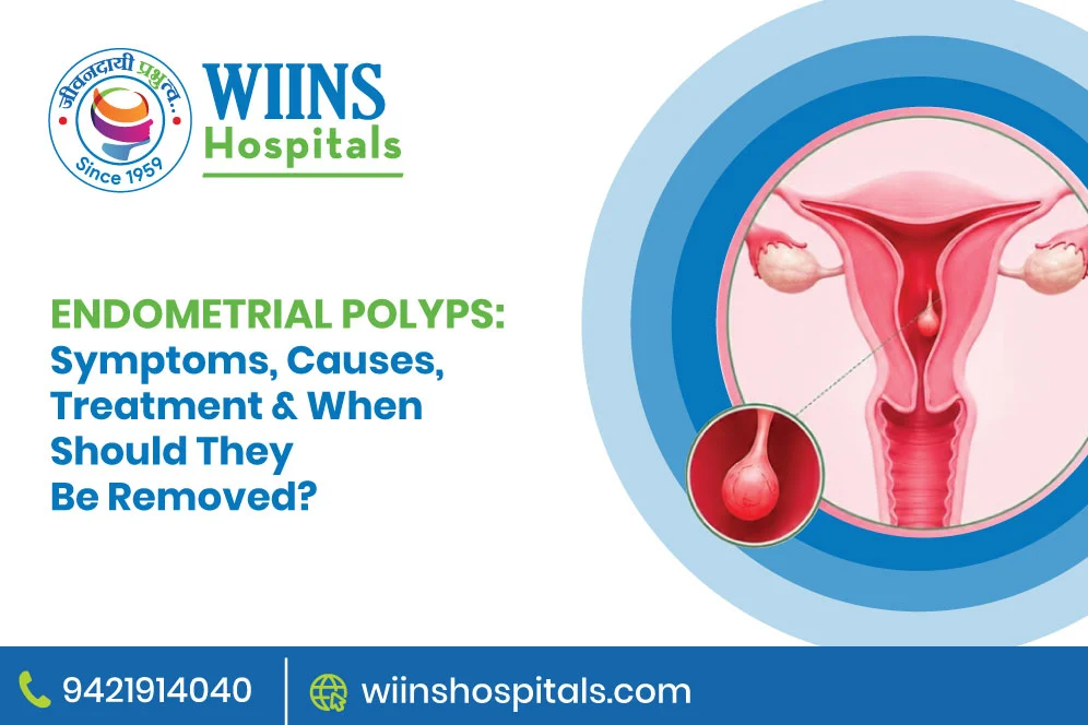 Endometrial Polyps: Symptoms, Causes, Treatment & When Should They Be Removed?