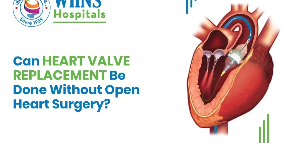 Can Heart Valve Replacement Be Done Without Open-Heart Surgery? Can Heart Valve Replacement Be Done Without Open-Heart Surgery?