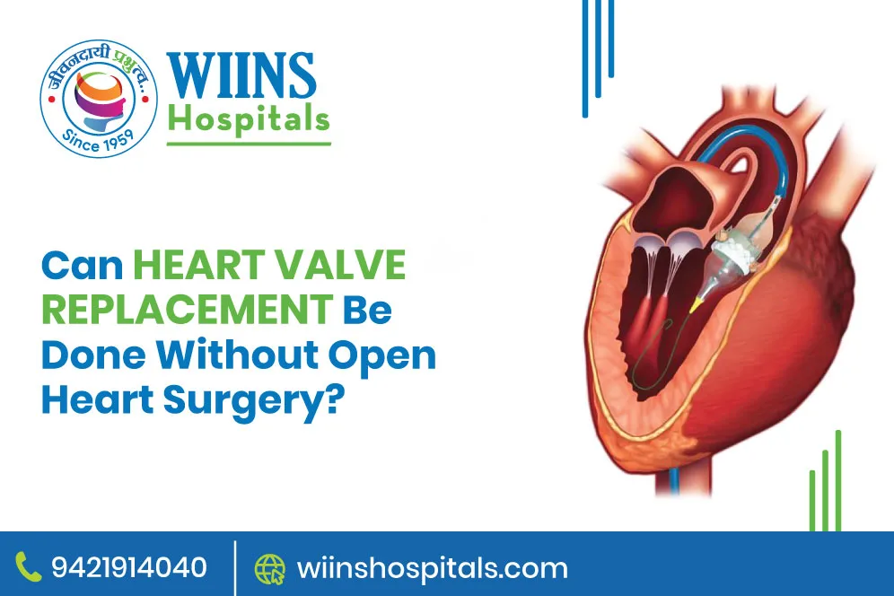 Can Heart Valve Replacement Be Done Without Open-Heart Surgery?