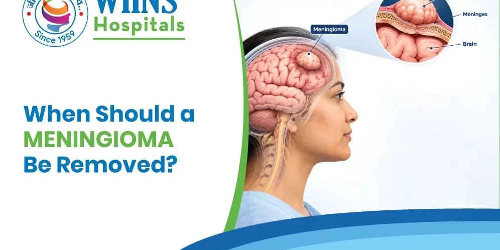 When Should a Meningioma Be Removed? When Should a Meningioma Be Removed?