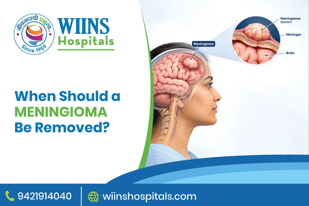 When Should a Meningioma Be Removed?