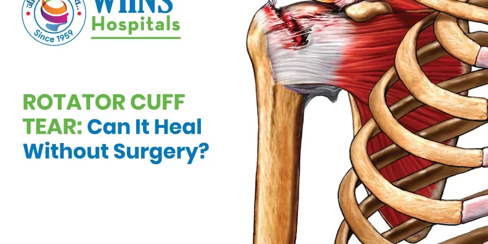 Rotator Cuff Tear: Can It Heal Without Surgery? Rotator Cuff Tear: Can It Heal Without Surgery?