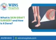 What Is Skin Graft Surgery and How Is It Done?