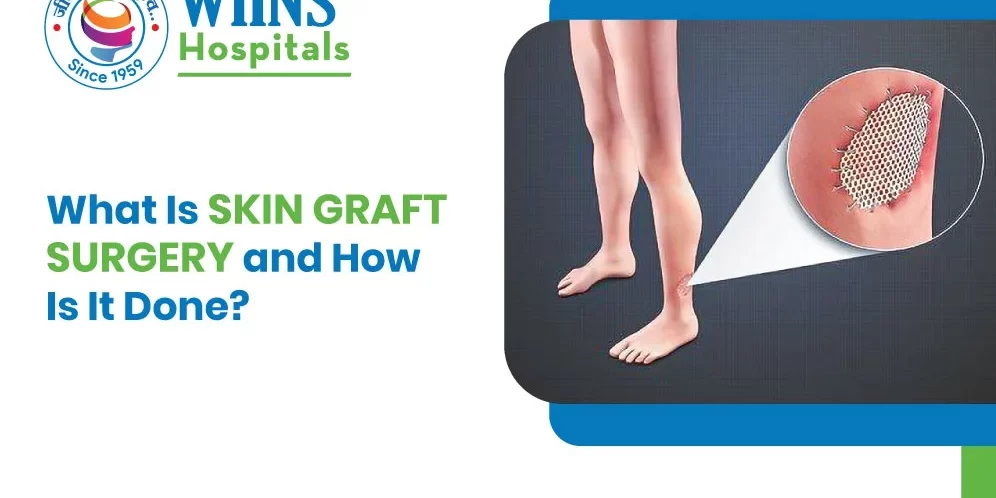 What Is Skin Graft Surgery and How Is It Done? What Is Skin Graft Surgery and How Is It Done?