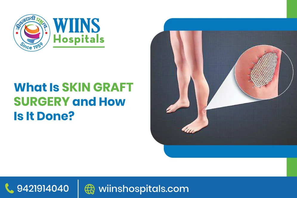 What Is Skin Graft Surgery and How Is It Done?
