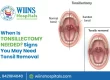 When Is Tonsillectomy Needed? Signs You May Need Tonsil Removal